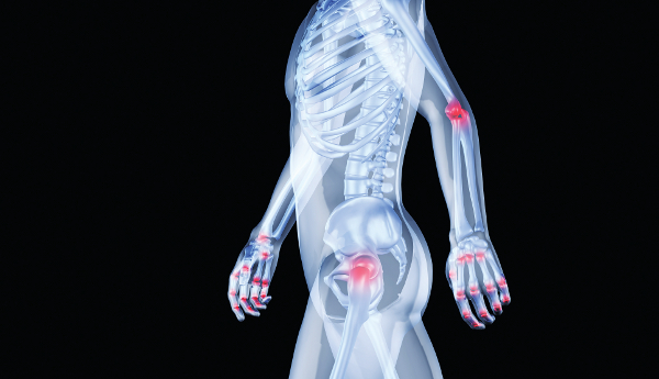 arthrwseis906
